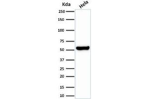 Western Blot Analysis of HeLa cell lysate using HSP60 Rabbit Recombinant Monoclonal Antibody (HSPD1/2206R).