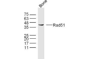 Mouse bone lysates probed with Rad51 Polyclonal Antibody, Unconjugated  at 1:300 overnight at 4˚C. (RAD51 anticorps  (AA 81-180))