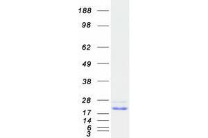 Validation with Western Blot