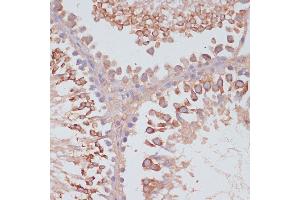 anti-Mitochondrial Ribosomal Protein L41 (MRPL41) (AA 1-137) antibody