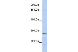 WB Suggested Anti-SFRP2 Antibody Titration: 0. (SFRP2 anticorps  (Middle Region))