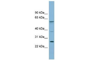 WB Suggested Anti-GDAP2 Antibody Titration: 0.
