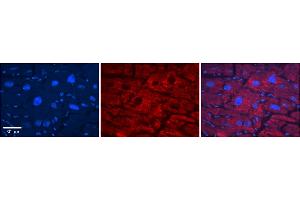 Rabbit Anti-SLC33A1 Antibody    Formalin Fixed Paraffin Embedded Tissue: Human Adult heart  Observed Staining: Cytoplasmic,Membrane Primary Antibody Concentration: 1:600 Secondary Antibody: Donkey anti-Rabbit-Cy2/3 Secondary Antibody Concentration: 1:200 Magnification: 20X Exposure Time: 0.