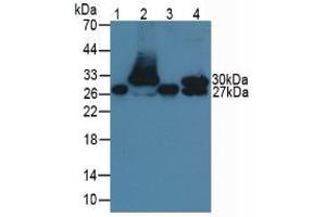 Figure. (TNNI1 anticorps  (AA 1-187))