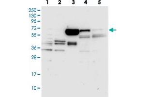 Western blot analysis of Lane 1: RT-4, Lane 2: U-251 MG, Lane 3: Human Plasma, Lane 4: Liver, Lane 5: Tonsil with C12orf26 polyclonal antibody . (METTL25 anticorps)