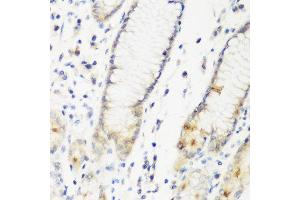 Immunohistochemistry of paraffin-embedded human gastric using DHODH antibody at dilution of 1:200 (40x lens). (DHODH anticorps)