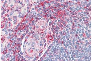 Human Spleen: Formalin-Fixed, Paraffin-Embedded (FFPE) (MVP anticorps  (AA 1-894))