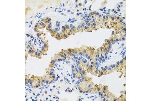 Immunohistochemistry of paraffin-embedded mouse lung using UVRAG antibody.