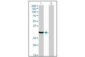 Western Blotting (WB) image for anti-Protein Kinase, Interferon-Inducible Double Stranded RNA Dependent Activator (PRKRA) antibody (ABIN781891) (PRKRA anticorps)
