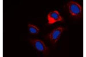 Immunofluorescent analysis of Phospholamban (pS16/T17) staining in HuvEc cells. (Phospholamban anticorps  (N-Term, pSer16, pSer17))