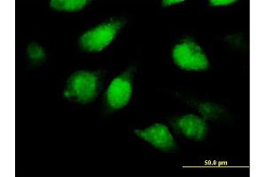 Immunofluorescence of purified MaxPab antibody to TSNAXIP1 on HeLa cell. (Tsnaxip1 anticorps  (AA 1-366))
