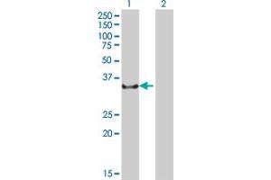 Western Blot analysis of NCR1 expression in transfected 293T cell line ( H00009437-T01 ) by NCR1 MaxPab polyclonal antibody. (NCR1 anticorps  (AA 22-303))