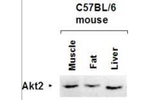 Western Blot of Rabbit anti-AKT2 antibody. (AKT2 anticorps  (AA 455-468))