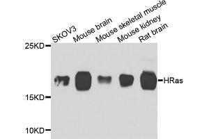 Western blot analysis of extracts of various cell lines, using HRAS antibody. (HRAS anticorps)