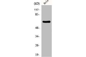 Western Blot analysis of HeLa cells using EAAT1 Polyclonal Antibody