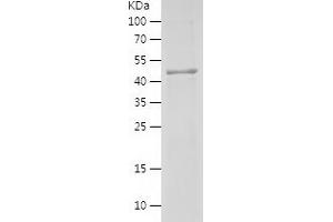 Western Blotting (WB) image for Folliculin (FLCN) (AA 364-579) protein (His-IF2DI Tag) (ABIN7122986)