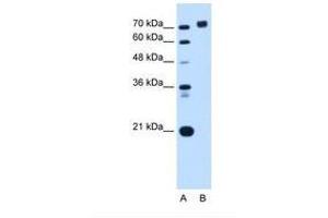 Image no. 1 for anti-Protein Tyrosine Phosphatase, Receptor Type, N (PTPRN) (AA 32-81) antibody (ABIN6738163) (PTPRN anticorps  (AA 32-81))