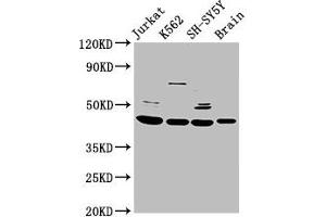Western Blot Positive WB detected in: Jurkat whole cell lysate, K562 whole cell lysate, SH-SY5Y whole cell lysate, Rat brain tissue All lanes: HOXD3 antibody at 8. (HOXD3 anticorps  (AA 263-346))