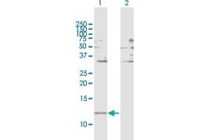Western Blot analysis of FABP1 expression in transfected 293T cell line by FABP1 MaxPab polyclonal antibody. (FABP1 anticorps  (AA 1-127))