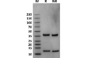 Human FcRn on Coomassie Blue stained SDS-PAGE under non-reducing (NR) and reducing (R) conditions.