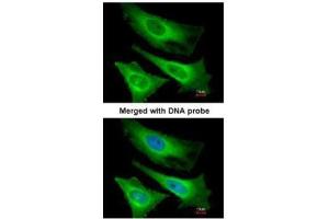 ICC/IF Image Immunofluorescence analysis of paraformaldehyde-fixed HeLa, using TNNI3K, antibody at 1:200 dilution.