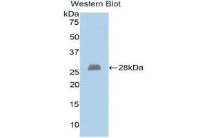 Western Blotting (WB) image for anti-Exostosin 1 (EXT1) (AA 334-549) antibody (ABIN1176519) (EXT1 anticorps  (AA 334-549))