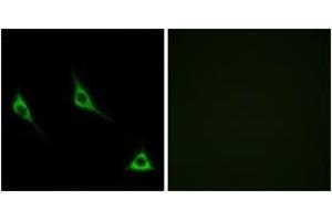 Immunofluorescence analysis of LOVO cells, using OR51A7 Antibody. (OR51A7 anticorps  (AA 232-281))