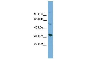 YIPF2 antibody used at 0. (YIPF2 anticorps  (Middle Region))