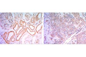 Immunohistochemical analysis of paraffin-embedded human salivary gland tissues (left) and kidney tissues (right) using HK1 mouse mAb with DAB staining. (Hexokinase 1 anticorps)