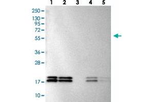Western blot analysis of Lane 1: RT-4, Lane 2: U-251 MG, Lane 3: Human Plasma, Lane 4: Liver, Lane 5: Tonsil with NME1-NME2 polyclonal antibody  at 1:100-1:250 dilution. (NME1 anticorps)