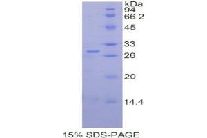 SDS-PAGE analysis of Human Renal Tumor Antigen Protein. (MOK Protéine)