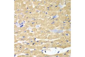 Immunohistochemistry of paraffin-embedded mouse heart using HAX1 antibody. (HAX1 anticorps)