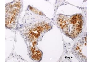 Immunoperoxidase of monoclonal antibody to PPP1R2P3 on formalin-fixed paraffin-embedded human testis. (PPP1R2P3 anticorps  (AA 1-205))