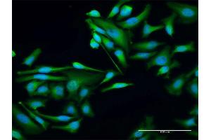 Immunofluorescence of purified MaxPab antibody to WTIP on HeLa cell.