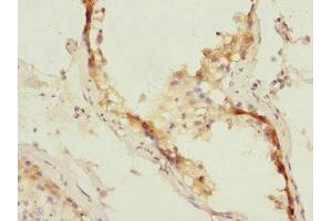 Immunohistochemistry of paraffin-embedded human testis tissue using ABIN7151071 at dilution of 1:100