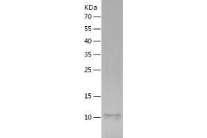 Western Blotting (WB) image for Chemokine (C-X-C Motif) Ligand 1 (Melanoma Growth Stimulating Activity, Alpha) (CXCL1) (AA 35-107) (Active) protein (His tag) (ABIN7122318)