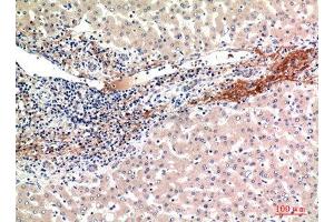 Immunohistochemistry (IHC) analysis of paraffin-embedded Human Liver, antibody was diluted at 1:100.