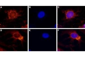 Expression of TRPV4 in rat DRG primary culture - Immunocytochemical staining of paraformaldehyde-fixed and permeabilized rat dorsal root ganglion (DRG) primary culture.