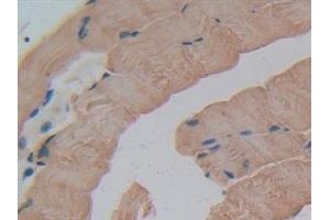Detection of GSTt1 in Mouse Skeletal muscle Tissue using Polyclonal Antibody to Glutathione S Transferase Theta 1 (GSTt1)