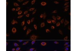 Immunofluorescence analysis of L929 cells using NTPCR Polyclonal Antibody at dilution of 1:100. (C1orf57 anticorps)