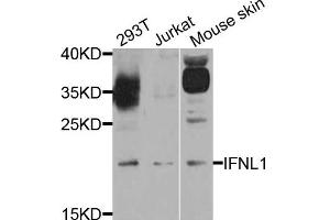 Western blot analysis of extract of various cells, using IFNL1 antibody. (IL29 anticorps)