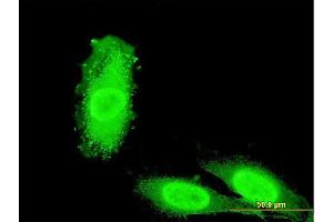 Immunofluorescence of monoclonal antibody to IRAK3 on HeLa cell. (IRAK3 anticorps  (AA 497-596))