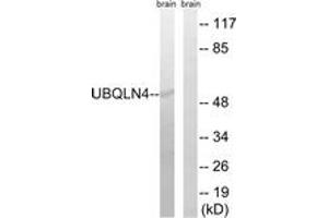 Western blot analysis of extracts from mouse brain cells, using UBQLN4 Antibody. (UBQLN4 anticorps  (AA 201-250))