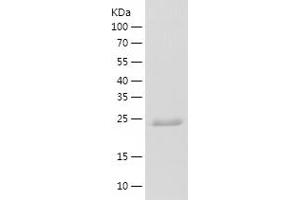Western Blotting (WB) image for Prostaglandin E Synthase 2 (PTGES2) (AA 1-206) protein (His-IF2DI Tag) (ABIN7124608)