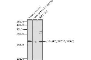 Western blot analysis of extracts of various cell lines, using p16-ARC//p16-ARC// antibody (ABIN6128967, ABIN6137131, ABIN6137132 and ABIN6224672) at 1:1000 dilution. (ARPC5 anticorps  (AA 1-154))