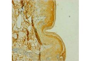 Immunohistochemistry of paraffin-embedded human skin tissue using ABIN7146852 at dilution of 1:100