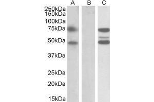HEK293 lysate (10ug protein in RIPA buffer) overexpressing Human ASNSD1 with DYKDDDDK tag probed with ABIN5539631 (1ug/ml) in Lane A and probed with anti-DYKDDDDK Tag (1/10000) in lane C. (ASNSD1 anticorps  (Internal Region))