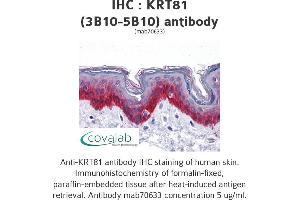 Image no. 1 for anti-Keratin 81 (KRT81) (AA 1-203), (full length) antibody (ABIN1723490)