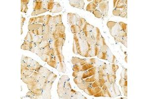Immunohistochemistry of paraffin embedded rat skeletal muscle using Sarcomeric α Actinin (ABIN7075510) at dilution of 1:1000 (200x lens) (Sarcomeric alpha Actinin anticorps)