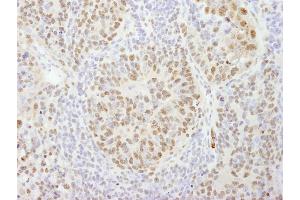 Immunohistochemistry (IHC) image for anti-Cleavage and Polyadenylation Specific Factor 1, 160kDa (CPSF1) (AA 1392-1442) antibody (ABIN7448944)